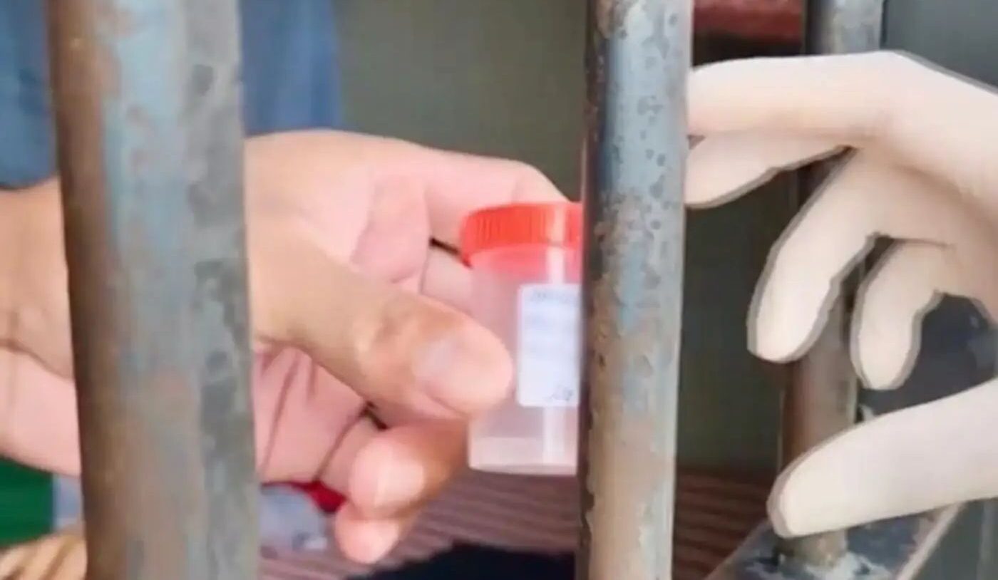 Amapá é destaque por ações de prevenção e controle da tuberculose no sistema penitenciário